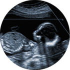 Ultrasound Image of Fetus